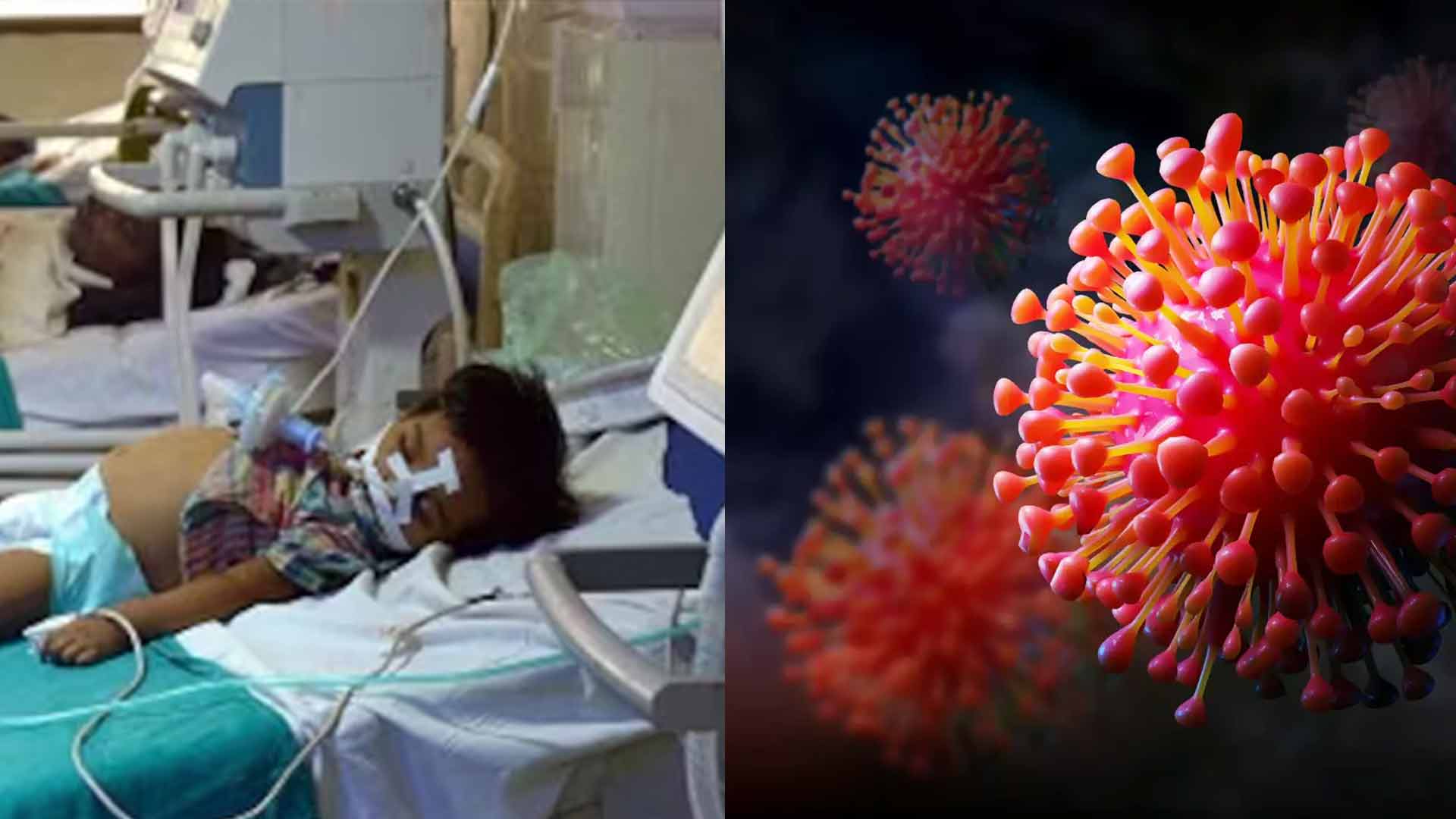 Breaking News: Chandipura Virus Suspected in Gujarat and Rajasthan, Six Children Dead and Cases Rising